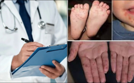 दिल्‍ली: छोटे बच्चों में तेजी से फैल रही एचएफएमडी बीमारी, जानें लक्षण क्या